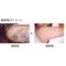 [D:F946]tattoo removal[D:F946]